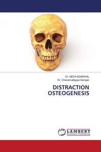 Enlarge image Cover: DISTRACTION OSTEOGENESIS - LAP Lambert Academic Publishing
