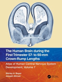 Abbildung von: The Human Brain during the First Trimester 57- to 60-mm Crown-Rump Lengths - CRC Press