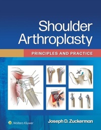 Abbildung von: Shoulder Arthroplasty - Wolters Kluwer Health