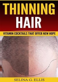 Abbildung von: Thinning Hair - Urgesta AS