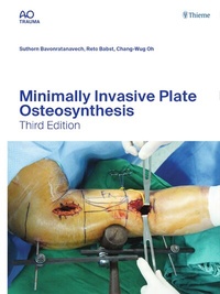 Abbildung von: Minimally Invasive Plate Osteosynthesis - Thieme