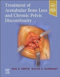 Cover: Treatment of Acetabular Bone Loss and Chronic Pelvic Discontinuity - Elsevier