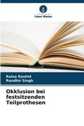 Cover: Okklusion bei festsitzenden Teilprothesen - Verlag Unser Wissen