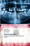 Cover: Osseointegration - Scholars' Press