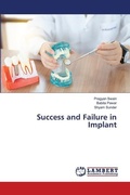 Cover: Success and Failure in Implant - LAP Lambert Academic Publishing