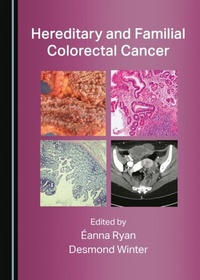 Abbildung von: Hereditary and Familial Colorectal Cancer - Cambridge Scholars Publishing
