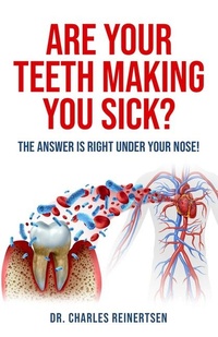 Abbildung von: Are Your Teeth Making You Sick? - Higherlife Development Service