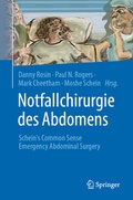 Cover: Notfallchirurgie des Abdomens - Springer