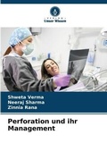 Cover: Perforation und ihr Management - Verlag Unser Wissen