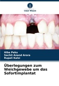 Cover: UEberlegungen zum Weichgewebe um das Sofortimplantat - Verlag Unser Wissen