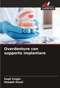 Cover: Overdenture con supporto implantare - Edizioni Sapienza
