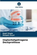 Cover: Implantatgetragene Deckprothese - Verlag Unser Wissen