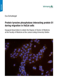 Abbildung von: Protein tyrosine phosphatase interacting protein 51 during migration in HaCat cells - Lehmanns Media