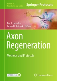 Abbildung von: Axon Regeneration - Humana