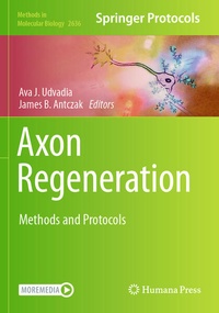 Abbildung von: Axon Regeneration - Springer