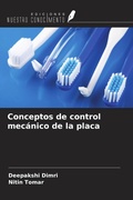 Cover: Conceptos de control mec&aacute;nico de la placa - Ediciones Nuestro Conocimiento