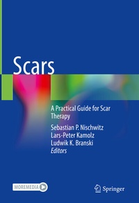 Abbildung von: Scars - Springer