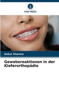 Cover: Gewebereaktionen in der Kieferorthopaedie - Verlag Unser Wissen