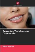 Cover: Reaccoes Teciduais na Ortodontia - Edicoes Nosso Conhecimento