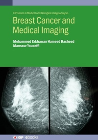 Abbildung von: Breast Cancer and Medical Imaging - Institute of Physics Publishing