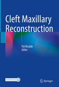 Abbildung von: Cleft Maxillary Reconstruction - Springer