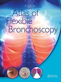 Abbildung von: Atlas of Flexible Bronchoscopy - CRC Press