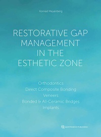 Abbildung von: Restorative Gap Management in the Esthetic Zone - Quintessence Publishing Co. Ltd.