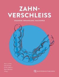 Abbildung von: Zahnverschleiß - Quintessenz Verlag