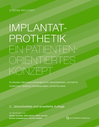 Abbildung von: Implantatprothetik - Quintessenz Verlag