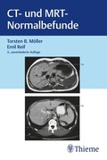 Cover: CT und MRT Normalbefunde - Thieme