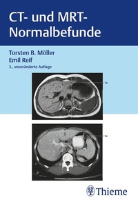 Abbildung von: CT und MRT Normalbefunde - Thieme