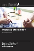 Cover: Implante pterigoideo - Ediciones Nuestro Conocimiento