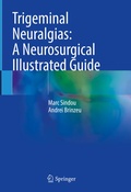 Cover: Trigeminal Neuralgias: A Neurosurgical Illustrated Guide - Springer