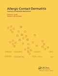 Cover: Allergic Contact Dermatitis - CRC Press