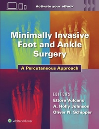 Abbildung von: Minimally Invasive Foot and Ankle Surgery - WOLTERS KLUWER HEALTH