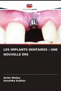 Cover: LES IMPLANTS DENTAIRES : UNE NOUVELLE &Egrave;RE - Editions Notre Savoir