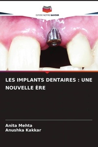 Enlarge image Cover: LES IMPLANTS DENTAIRES : UNE NOUVELLE ÈRE - Editions Notre Savoir