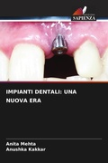 Cover: IMPIANTI DENTALI: UNA NUOVA ERA - Edizioni Sapienza