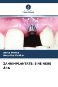 Cover: ZAHNIMPLANTATE: EINE NEUE &Auml;RA - Verlag Unser Wissen