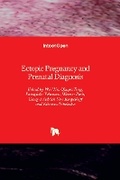 Cover: Ectopic Pregnancy and Prenatal Diagnosis - IntechOpen