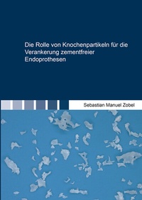 Abbildung von: Die Rolle von Knochenpartikeln für die Verankerung zementfreier Endoprothesen - Shaker