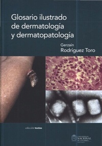 Abbildung von: Glosario ilustrado de dermatología y dermatopatología - Universidad Nacional de Colombia