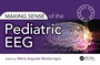 Cover: Making Sense of the Pediatric EEG - CRC Press