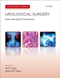 Abbildung von: Challenging Cases in Urological Surgery - OUP eBook