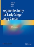 Bild: Segmentectomy for Early-Stage Lung Cancer - Springer
