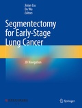 Bild: Segmentectomy for Early-Stage Lung Cancer - Springer