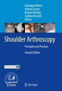 Abbildung von: Shoulder Arthroscopy - Springer