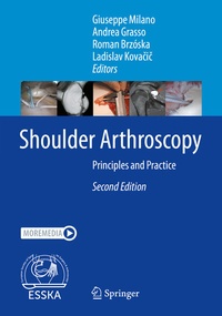 Abbildung von: Shoulder Arthroscopy - Springer
