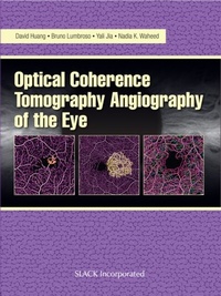 Abbildung von: Optical Coherencre Tomography Angiography of the Eye - SLACK Incorporated