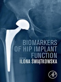 Abbildung von: Biomarkers of Hip Implant Function - Academic Press